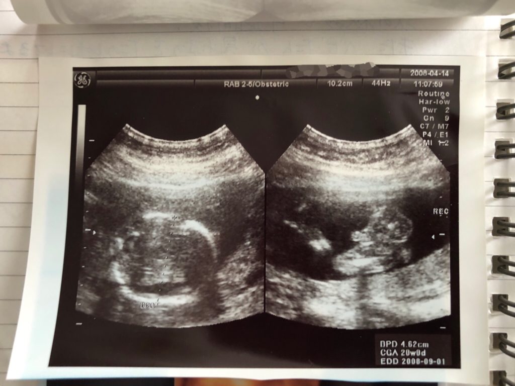 妊婦健診の記録 妊娠5ヶ月から9ヶ月 エコー写真有り 嘉藤三華の男児育児ブログ 怒ってごめんね